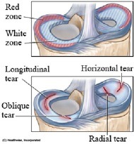 knee bone diagram