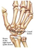 wrist pain bone diagram